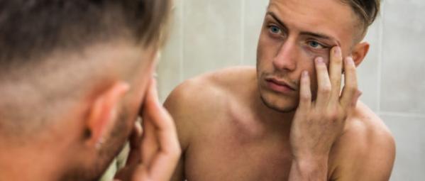 5 Ways To Banish Tired Looking Eyes This Christmas