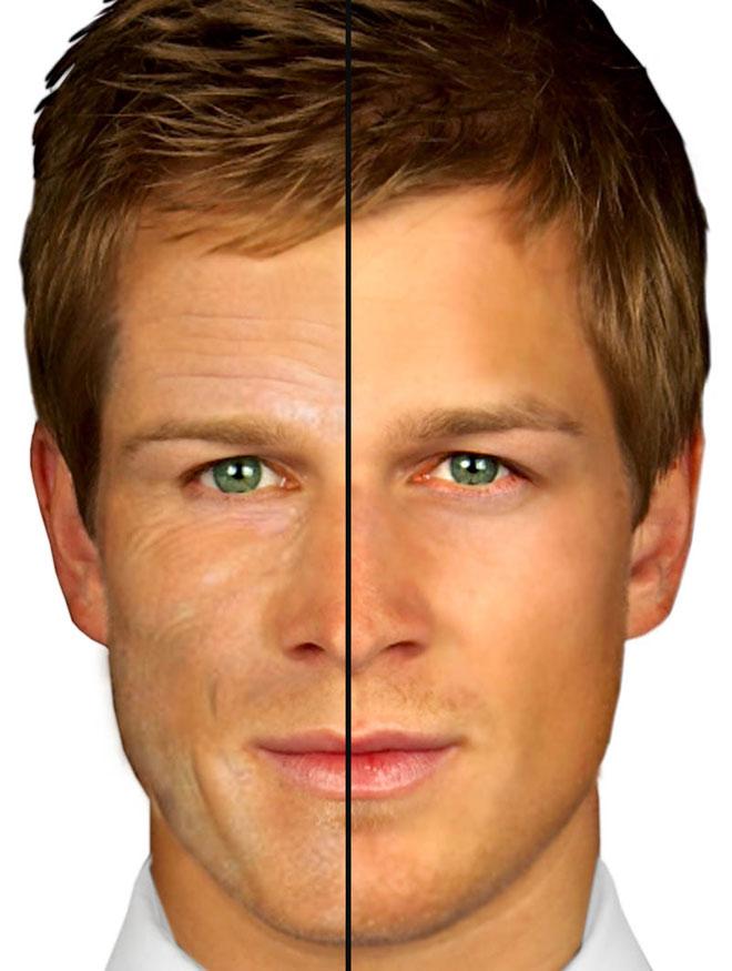 How to cover forehead blemishes