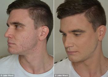 Men’s Makeup Before and After