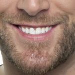 4 Tips to Tackle Beard Patchiness